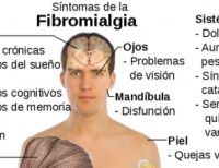 Fibromialgia, un reto para la medicina en Colombia