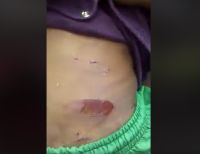 ICBF deja bajo protección a niño víctima de maltrato en Buenaventura