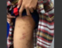 Alerta en Buenaventura: Menor adoptada es víctima de presunto maltrato
