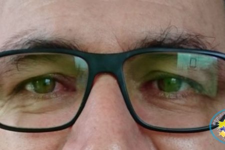 Ante brote de conjuntivitis, Secretaría de Salud de Buenaventura invita a la comunidad a tomar algunas medidas preventivas