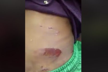 ICBF deja bajo protección a ni&ntilde;o víctima de maltrato en Buenaventura