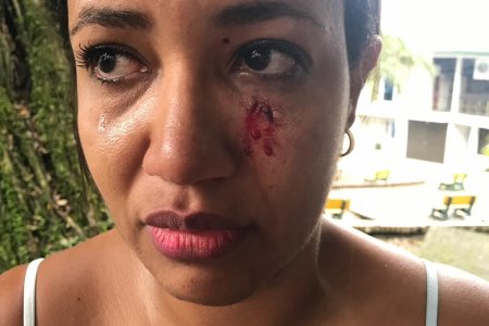 Se presentó un nuevo caso de violencia intrafamiliar en Buenaventura