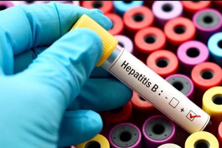 En Buenaventura la Hepatitis B se presenta más en las mujeres