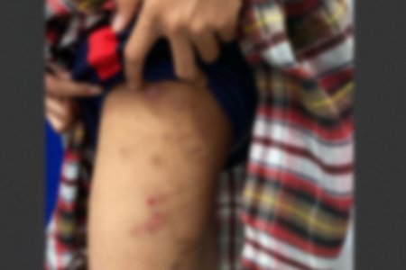 Alerta en Buenaventura: Menor adoptada es víctima de presunto maltrato