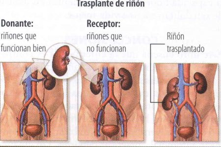 El Riñón a cuidados intensivos