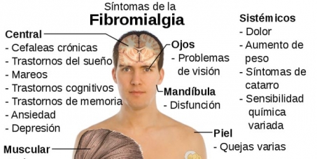 Fibromialgia, un reto para la medicina en Colombia