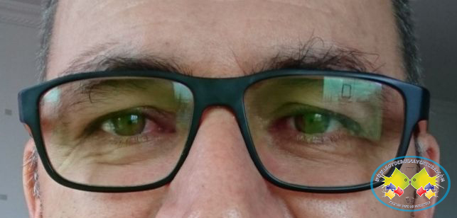 Ante brote de conjuntivitis, Secretaría de Salud de Buenaventura invita a la comunidad a tomar algunas medidas preventivas