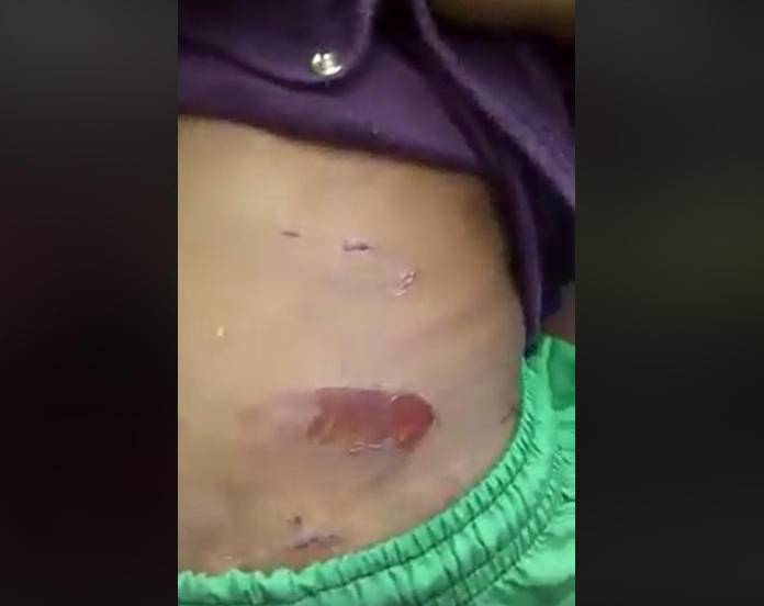 ICBF deja bajo protección a ni&ntilde;o víctima de maltrato en Buenaventura