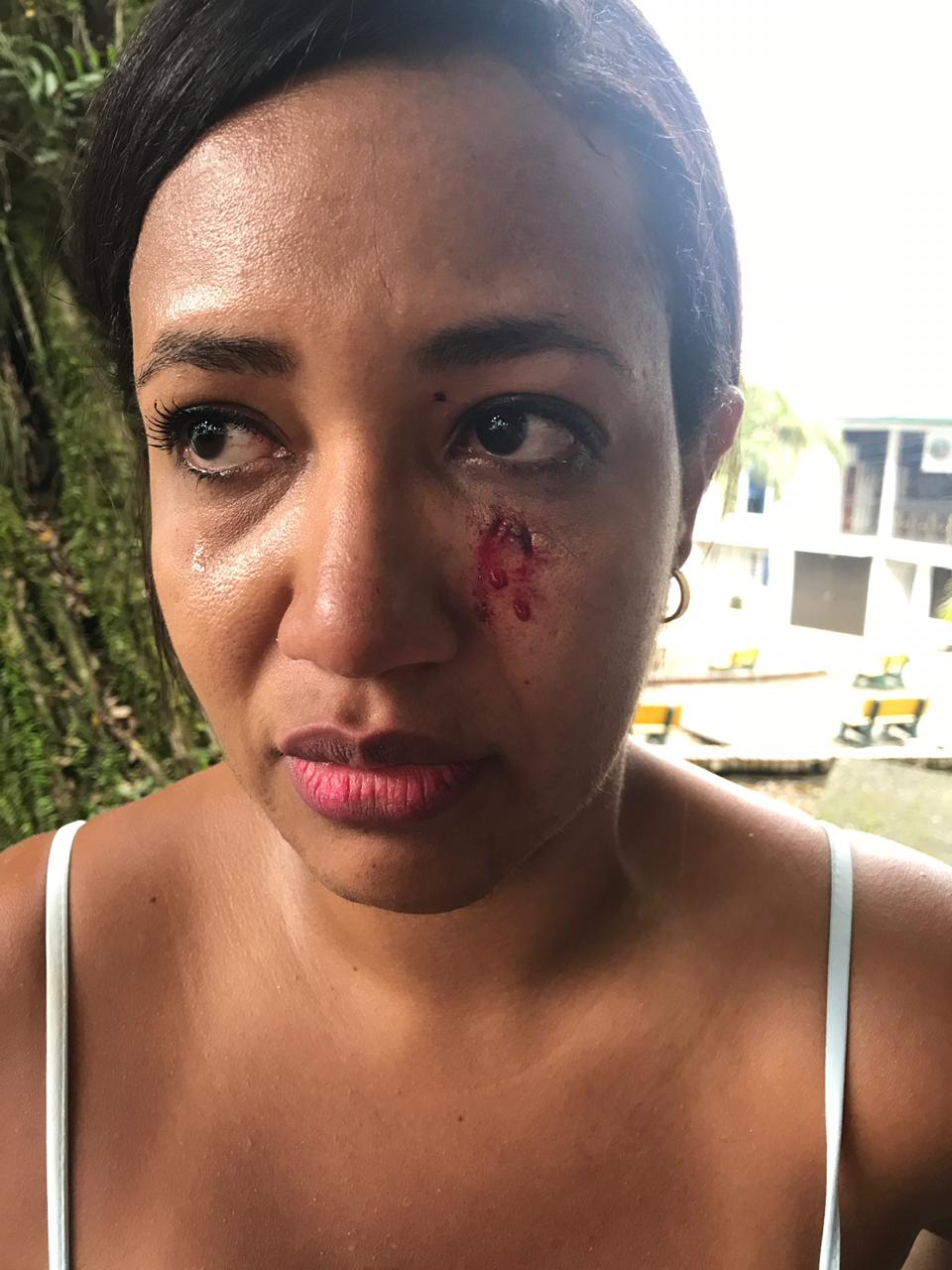 Se presentó un nuevo caso de violencia intrafamiliar en Buenaventura