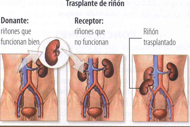 El Riñón a cuidados intensivos
